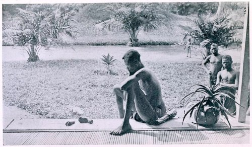 Nsala, of the district of Wala, looking at the severed hand and foot of his five-year old daughter, Boali, who was killed and allegedly cannibalized by the members of Anglo-Belgian India Rubber Company (A.B.I.R.) militia. Source: E. D Morel, King Leopold's rule in Africa, between pages 144 and 145